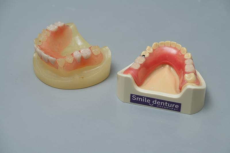 ノンクラスプデンチャーとは?